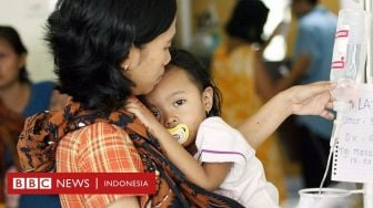 Hepatitis Akut: Terlalu Dini Jadi Pandemi, Tapi Bisa Picu Masalah Baru