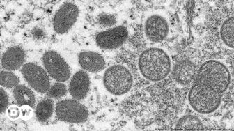 Penyebaran Infeksi Virus Cacar Monyet Terjadi di Eropa dan AS