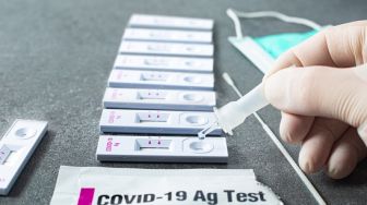 Muncul Covid-19 Subvarian Baru, IDI Minta Pemerintah Kembali Berlakukan Tes PCR dan Antigen untuk Pelaku Perjalanan