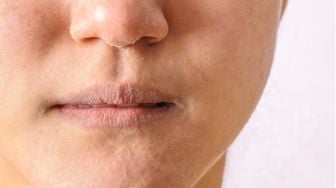 4 Kebiasaan yang Menyebabkan Bibir Terasa Kering dan Pecah-pecah