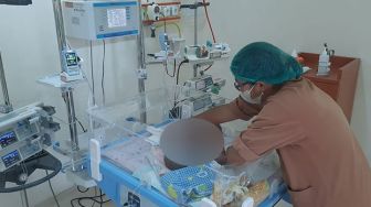 Kabar Terkini Bayi Kembar Siam Tiga Kaki Asal Asahan, Tim Dokter RSUP HAM Belum Pastikan Lakukan Operasi Pemisahan