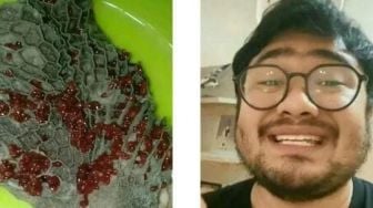 Video Viral Babat Sapi Dipenuhi Cacing Merah Jadi Sorotan, Berbahaya Kah? Simak Penjelasan Chef Nausa