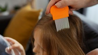 Cara Menghilangkan Kutu Rambut, Coba Pakai 7 Bahan Rumahan Ini