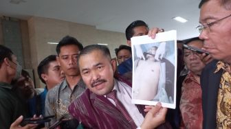 Diminta Terlibat dalam Autopsi Brigadir J, KSAL: Tunggu Keputusan Panglima TNI