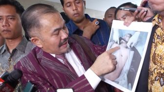 Demi Memastikan Penyebab Kematiannya, Beberapa Organ Tubuh Brigadir J akan Dibawa ke Jakarta