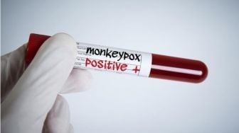 Varian Baru Cacar Monyet Terdeteksi di Inggris, Ini Riwayat Perjalanan Pasien