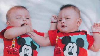 7 Fakta Anak Kembar Siam dengan Otak Menyatu Sukses Dipisahkan di Brasil, Pakai Bantuan Virtual Reality
