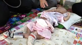 Alert! Bayi Berusia 24 Hari Lahir tanpa Anus di Pandeglang Butuh Bantuan