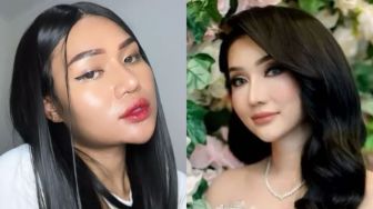 TikToker Popo Barbie Operasi Plastik, Warganet Bandingkan dengan Lucinta Luna