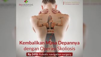 Eka Hospital Tangani Skoliosis dengan Robot Navigasi