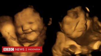 Bayi dalam Kandungan Tersenyum Ketika Merasakan Wortel