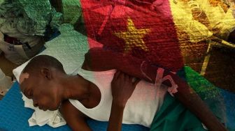 Penyakit Kolera Bunuh 110 Orang di Malawi