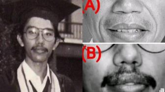 Dokter Tifa Tuding Foto Saat Jokowi Wisuda Tak Mirip Secara Ilmu Anatomi, Pelajaran Apa Sih Itu?