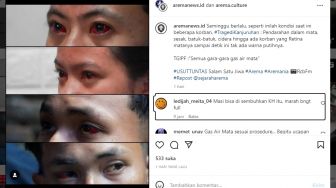 Kondisi Korban Selamat Tragedi Kanjuruhan Viral di IG, Mata Merah dan Sesak Nafas, Warganet: Marah Banget