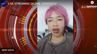 Annie Yang Minta Maaf Mundur dari SUCI X Karena Kecelakaan di Bali