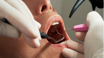 8 Langkah untuk Dapatkan Kondisi Gigi dan Mulut yang Sehat