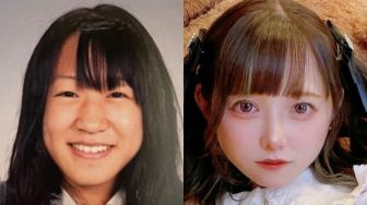 Gadis Jepang Jadi Kontroversi Setelah Ungkap Sudah Lakukan Operasi Plastik Sejak Kelas 5 SD, Begini Transformasinya
