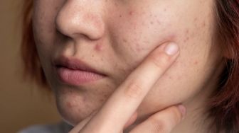 7 Cara Menghilangkan Pori-Pori Wajah, Mudah Dilakukan di Rumah