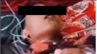 Pembullyan di Sekolah Terjadi Lagi, Bocah SD di Malang Terbaring Koma Hingga Tuntut Pelaku Wajib Dihukum