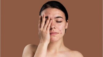 Hati-Hati, Inilah 5 Penyebab Utama Skin Barrier Rusak