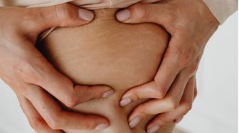 5 Cara Menghilangkan Stretch Mark Secara Alami, Wajib Kamu Coba!