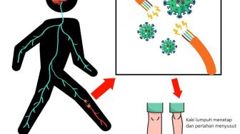 Kenali Bahaya KLB Polio, Masyarakat Diminta Penuhi Cakupan Imunisasi