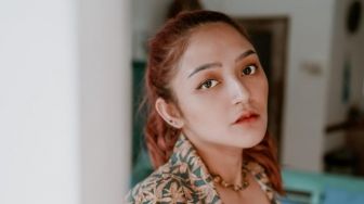 Semakin Cantik, Ini 10 Potret Transformasi Siti Badriah yang Dituding Lakukan Operasi Plastik