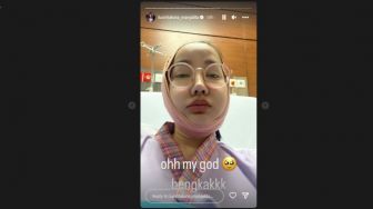 Muka Lucinta Luna Bengkak, Netizen Malah Tuding Gegara Efek Samping Potong Rahang