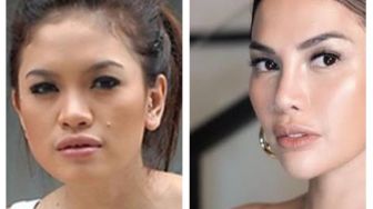 8 Foto Artis Sebelum dan Sesudah Operasi Plastik, Nikita Mirzani Lakukan di Bagian Hidung hingga Area Pribadinya