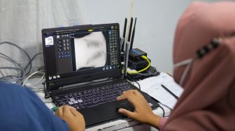 Kasus Tuberkulosis di Surabaya Tinggi, Pemerintah Ungkap Masih Banyak Masyarakat Malu Untuk Membuka Diri Terkena TBC