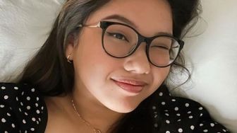 Calon Dokter Gigi, Ini 11 Potret Trisha Eungelica Putri Sulung Ferdy Sambo yang Jadi Sorotan