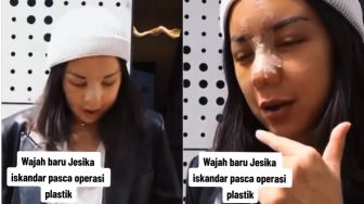 Wajah Jessica Iskandar Dinilai Berbeda Usai Operasi Plastik: Bagus Paras yang Asli, Kayak Hantu