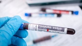 Masyarakat Diajak Mewaspadai Bahaya Virus Marburg