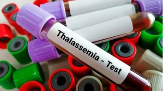 Apa Itu Penyakit Thalasemia? Begini Pengertian, Gejala dan Penyebabnya