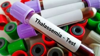 Waspada Orang Tua Turunkan Thalassemia pada Anak