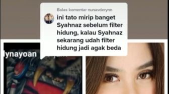 Pakar Tato Ungkap Makna Gambar Mirip Syahnaz Sadiqah di Punggung Rendy Kjaernett: Bukti Cinta yang Besar