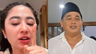 Fakta-fakta Sapi Kurban Dewi Perssik Ditolak RT, Ada Sentimen Politik Ganjar - Anies?