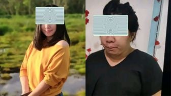 Ibu Hamil Ramai-ramai Pamer Pregnancy Nose di TikTok, Apa Sih Penyebabnya?