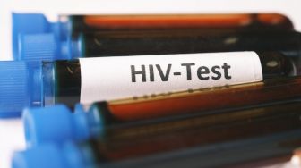 Selain Hubungan Seksual, Ini 6 Faktor Utama Penularan HIV yang Perlu Diketahui