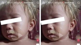 Duh! Ibu Nekat Bleaching Rambut Bayi 14 Bulan dan Ngotot Sudah BPOM, Netter Pusing: Gak Tertolong