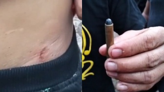 Karyawan Terluka Akibat Peluru Karet dan Gas Air Mata saat Demo di Kebun Sawit PT Duta Palma Agro Bengkayang Ricuh