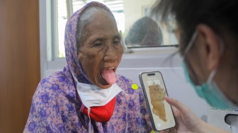 Pasien dengan gejala batuk dan sesak antre memeriksakan diri di Poli Batuk dan infeksi saluran pernapasan akut (ISPA) di Puskesmas Mampang Prapatan, Jakarta, Rabu (23/8/2023). [Suara.com/Alfian Winanto]