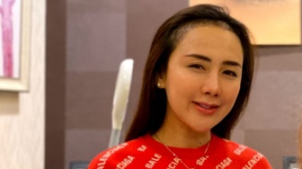 Punya Jidat Jenong, Ucie Sucita Beranikan Diri untuk Transplantasi Rambut