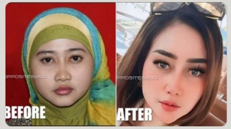 Foto Jadul Luluk Nuril Beredar, Perubahan Dagu dan Alis Bikin Salfok: Semua Akan Cantik Kalau Ada Uangnya