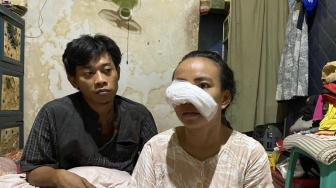 Ngamuk Gegara Cemburu, Wajah Istri Disayat Mantan Pacar Suami Pakai Pisau Cutter: Saya Lagi Tidur