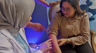 Terpapar Psoriasis Akibat Dampak Kemarau Panjang, Claudya Kesulitan Saat Keluar Ruangan