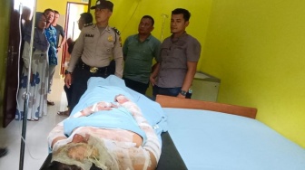 Cemburu Buta, Remaja di Langkat Bakar Istri Siri Hidup-hidup