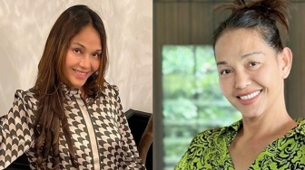 8 Potret Transformasi Bunda Corla, Habiskan 1,5 Miliar agar Makin Awet Muda