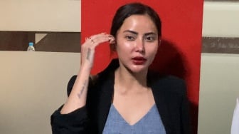 Ayu Aulia Sebut Polisi Sudah Kantongi Tersangka dari Laporan Ridwan Kamil