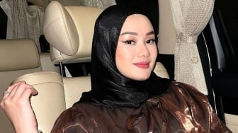 Efek Pakai Behel, Wajah Dinda Hauw Ramai Disebut Mirip Siti Atikoh